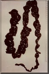 Toxic dysfunctional bowel creates autointoxication. Colon cleansing   is an important for health and wellness.